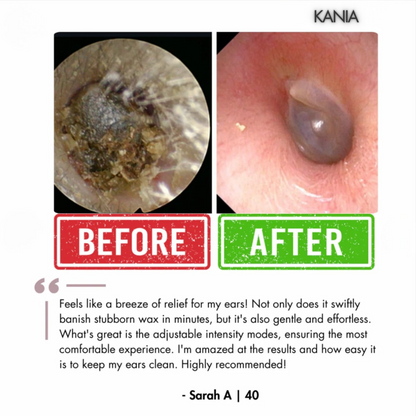 KANIA™ Electric Ear Wax Removal Kit
