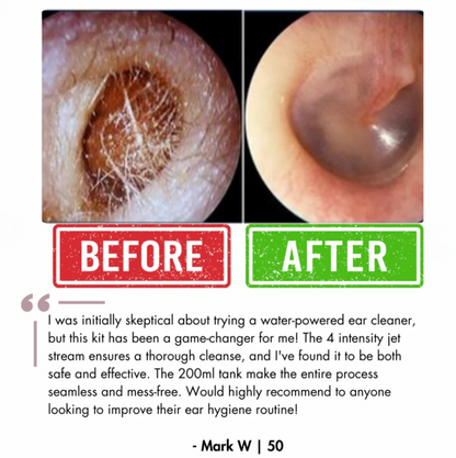 KANIA™ Electric Ear Wax Removal Kit